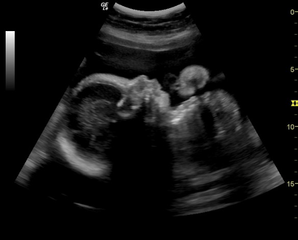 His profile. I just want to kiss those sweet lips!